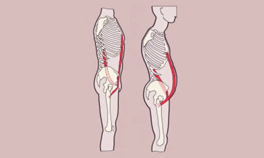 Psoas Major And Rectus Abdominis